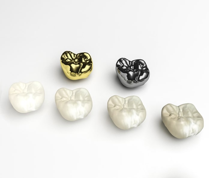dental crowns in varsity