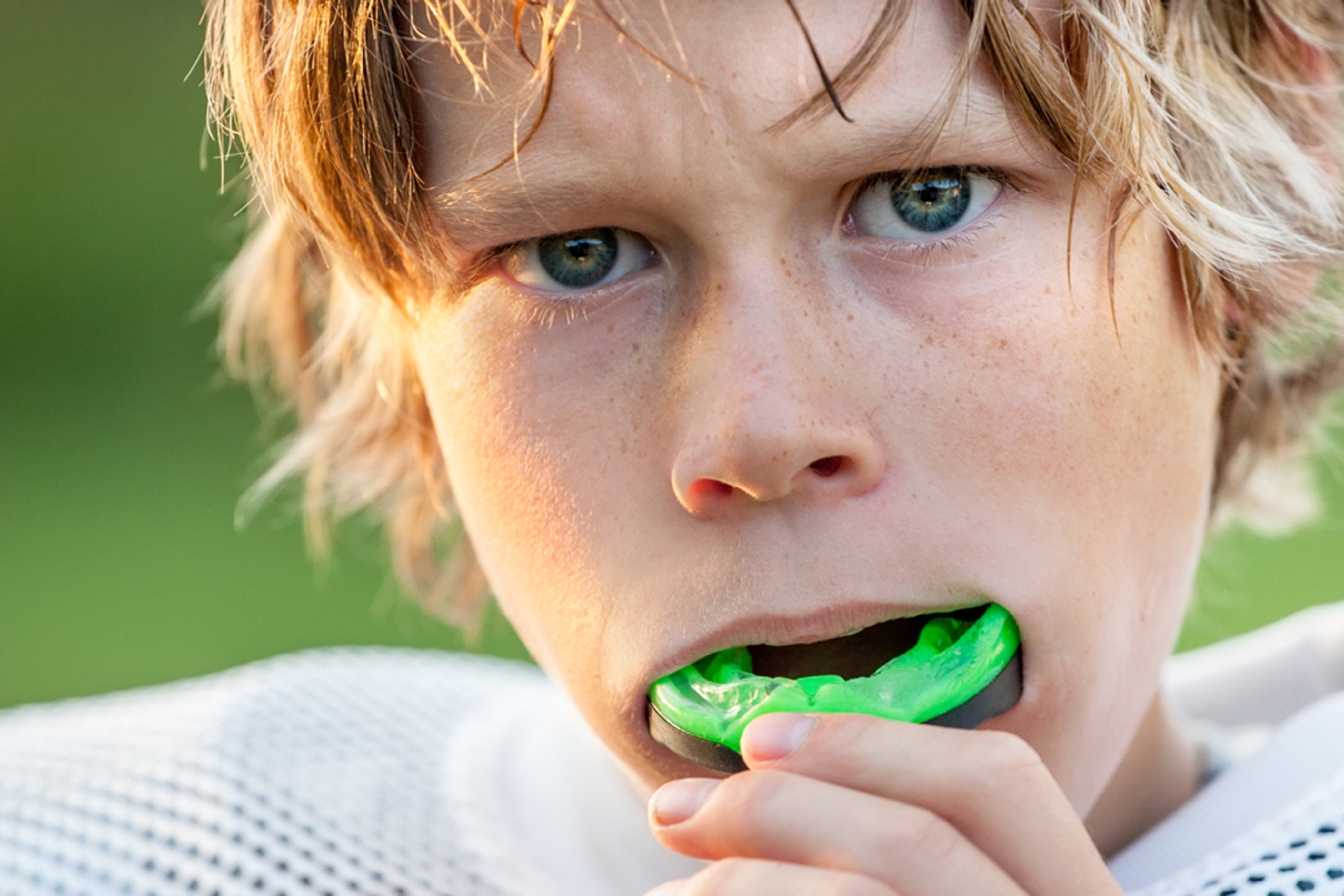 how mouthguards protect your childs teeth